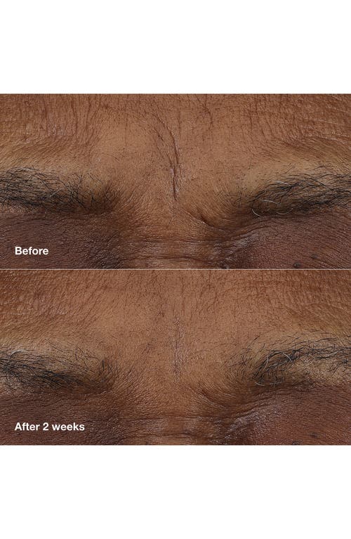 Clinique Smart Clinical Repair Am/pm Retinoid Balm In No Color