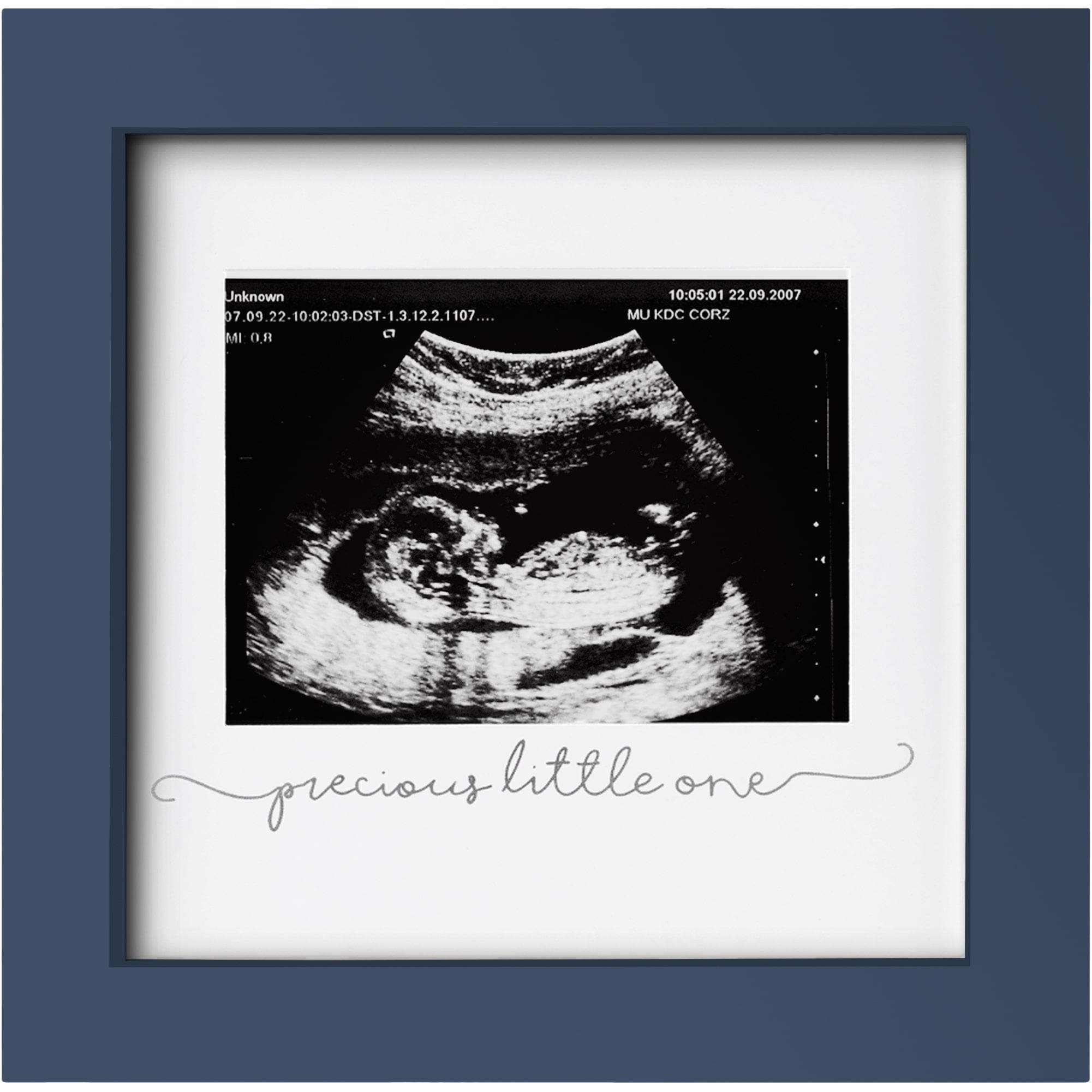 Keababies Kids'  Solo Baby Sonogram Frame In Midnight Blue