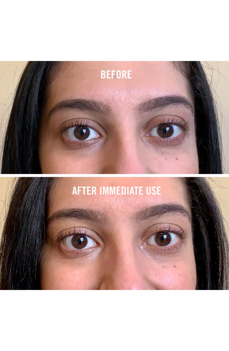 First Aid Beauty Eye Duty Niacinamide Brightening Cream Nordstrom