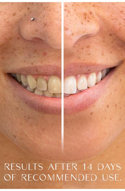 MOON MOON TEETH WHITENING PEN