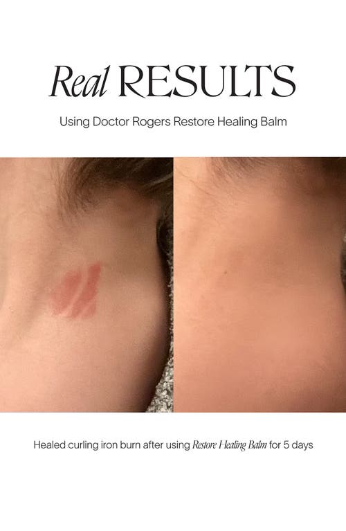 Doctor Rogers Restore Healing Balm In Medium Grey