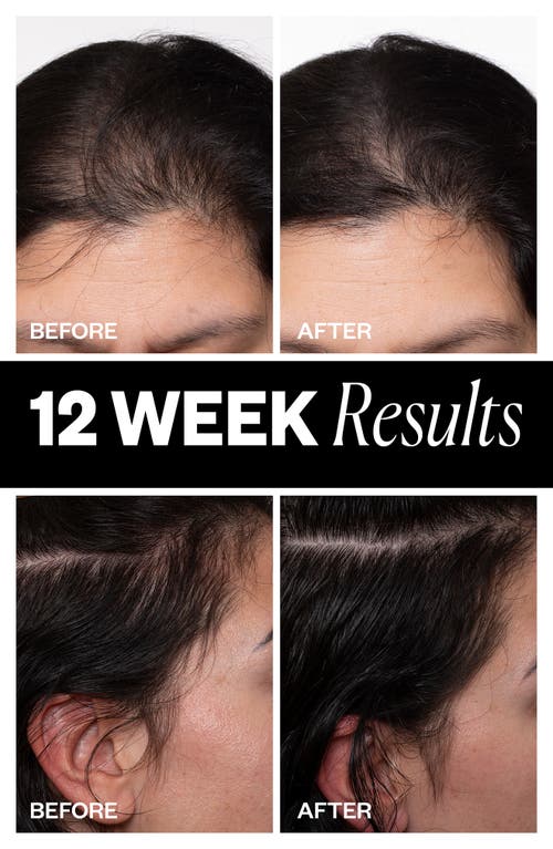 Igk Sponsored Hair Density Scalp Treatment For Thinning Hair 2.1 oz / 63 ml In No Color
