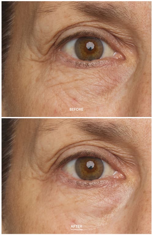True Botanicals Chebula Multi-corrective Eye Patches In No Color