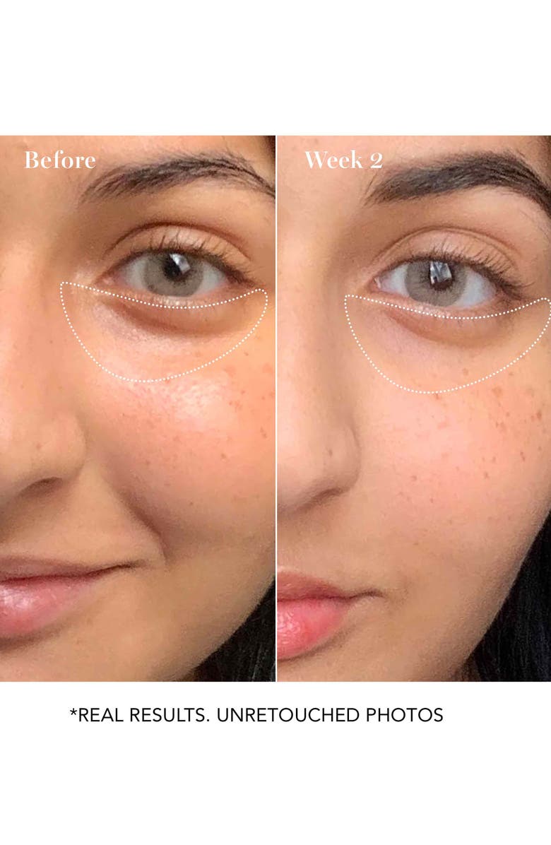 Saturday Skin Wide Awake Brightening Eye Cream Nordstrom