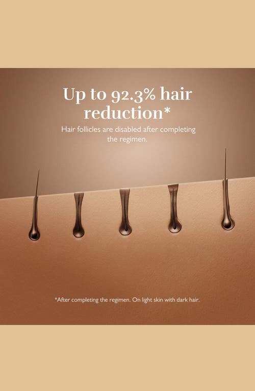 Silk'n 7 Hair Removal Device In Black