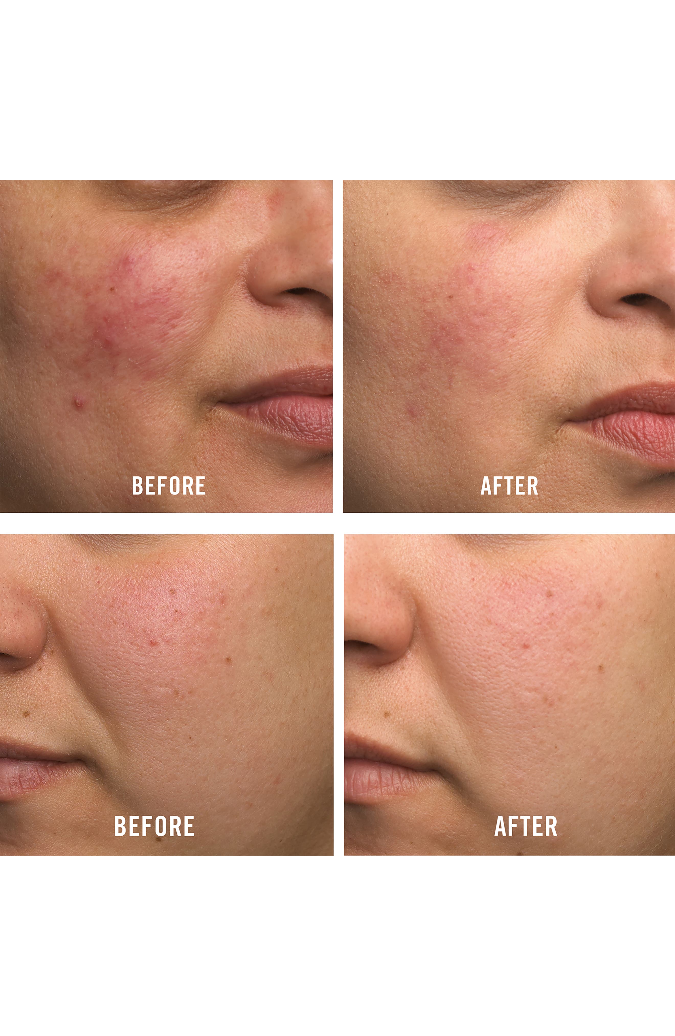 First Aid Beauty Ultra Repair Cream Intense Hydration Face & Body