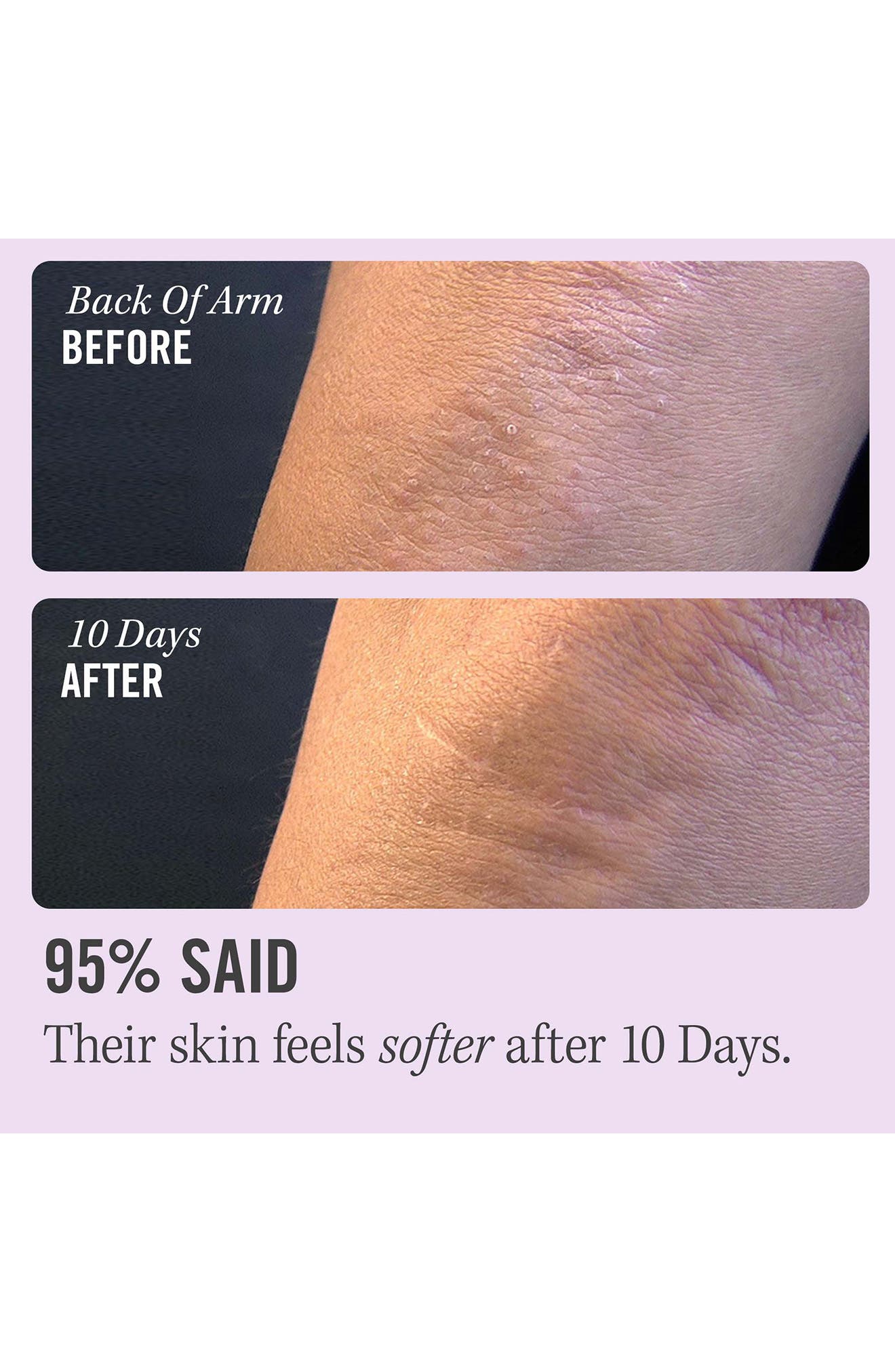 First Aid Beauty KP Bump Eraser Body Scrub Nordstrom