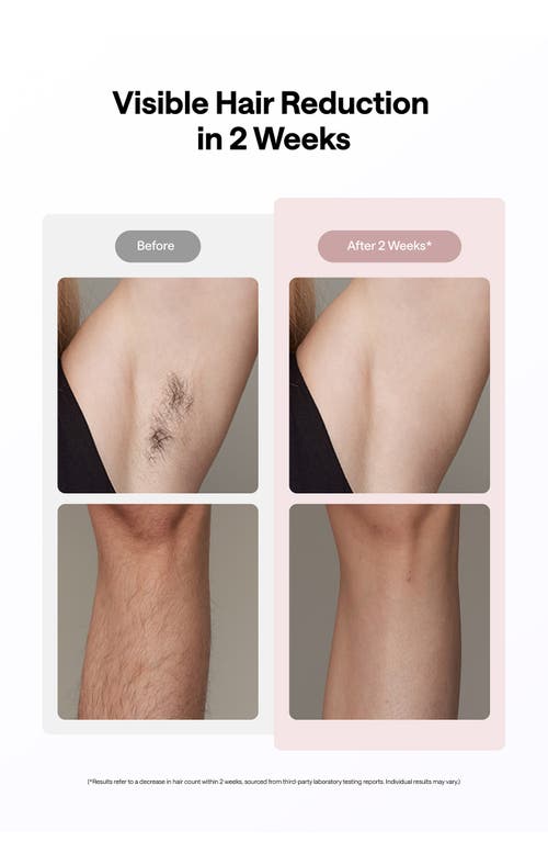 Ulike Air10 Ipl Hair Removal Device In Pink