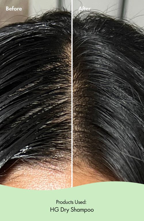 Bondiboost Hg Volumizing Dry Shampoo With Rosemary 3.95 oz In No Color