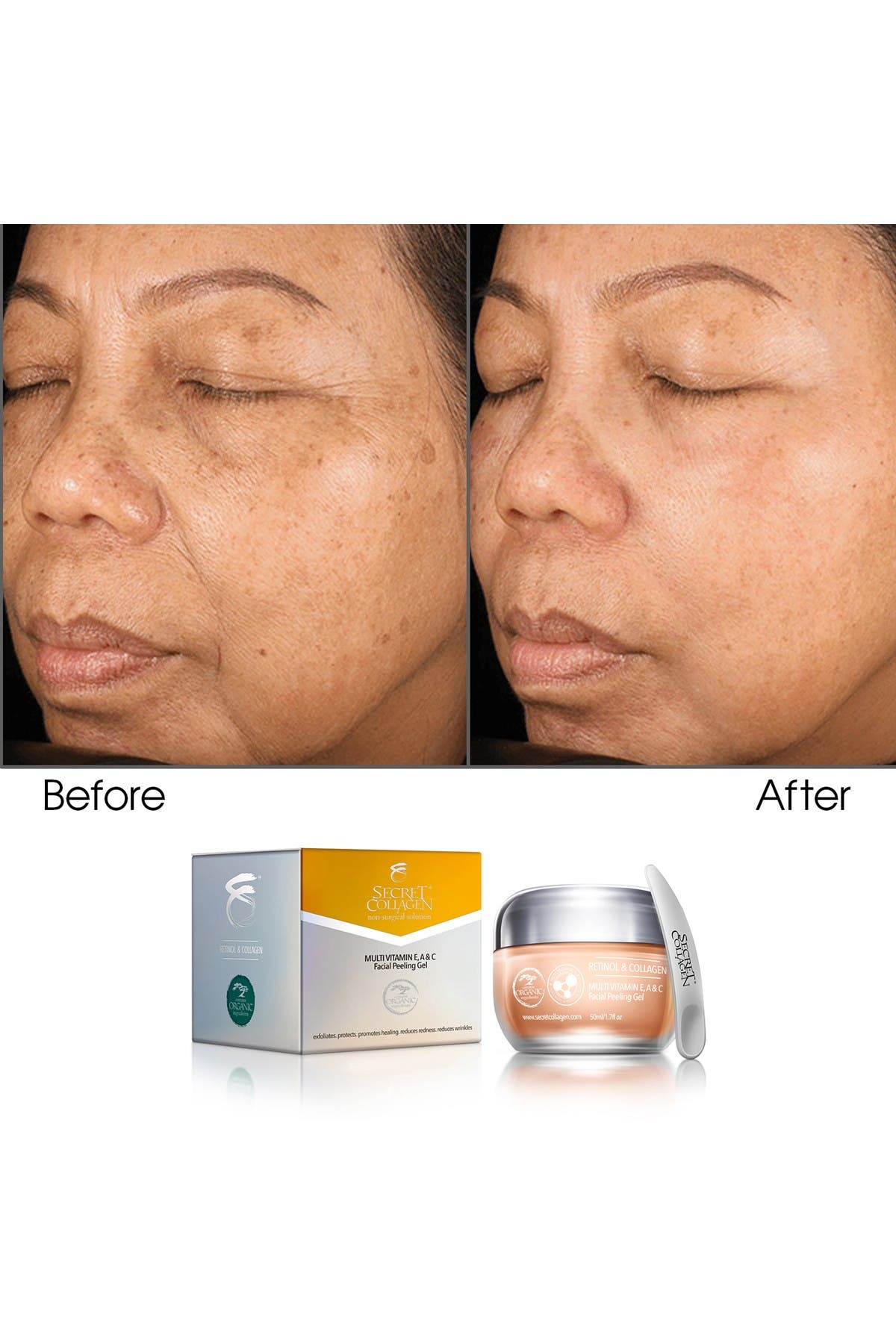 Secret Collagen Multi Vitamin E A C Facial Peeling Gel Hautelook