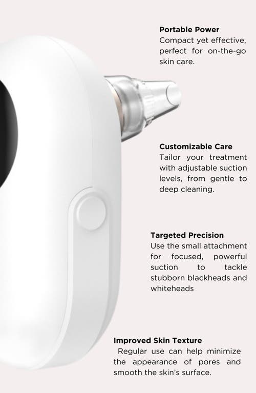 Solaris Laboratories Ny Pore Extractor Device In No Color