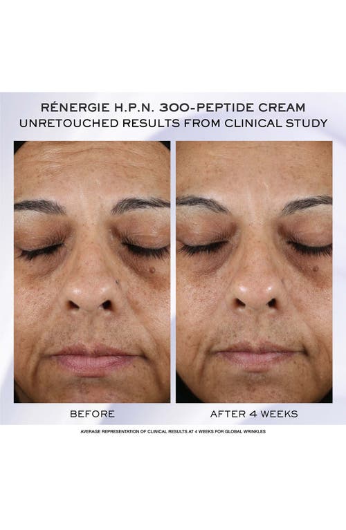 Lancôme Rénergie H.p.n. 300-peptide Cream Holiday Gift Set (limited Edition) $270 Value In No Color