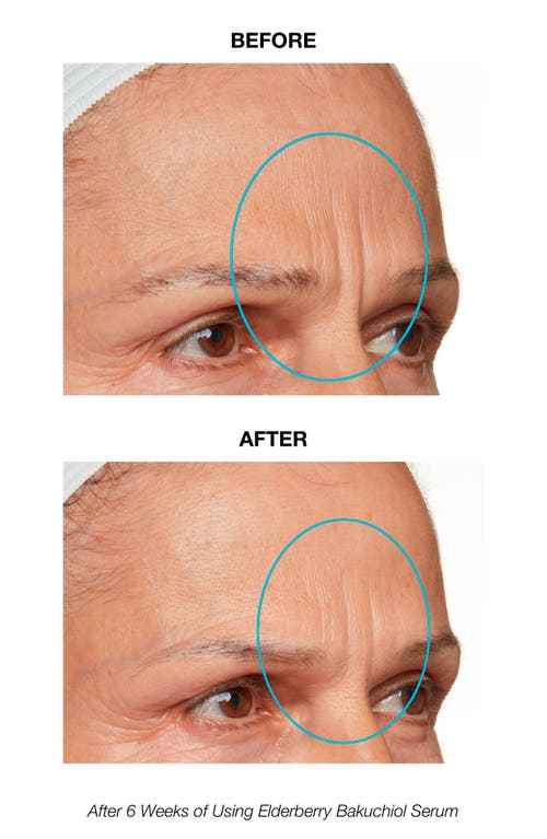 Angela Caglia Elderberry Bakuchiol Serum In No Color