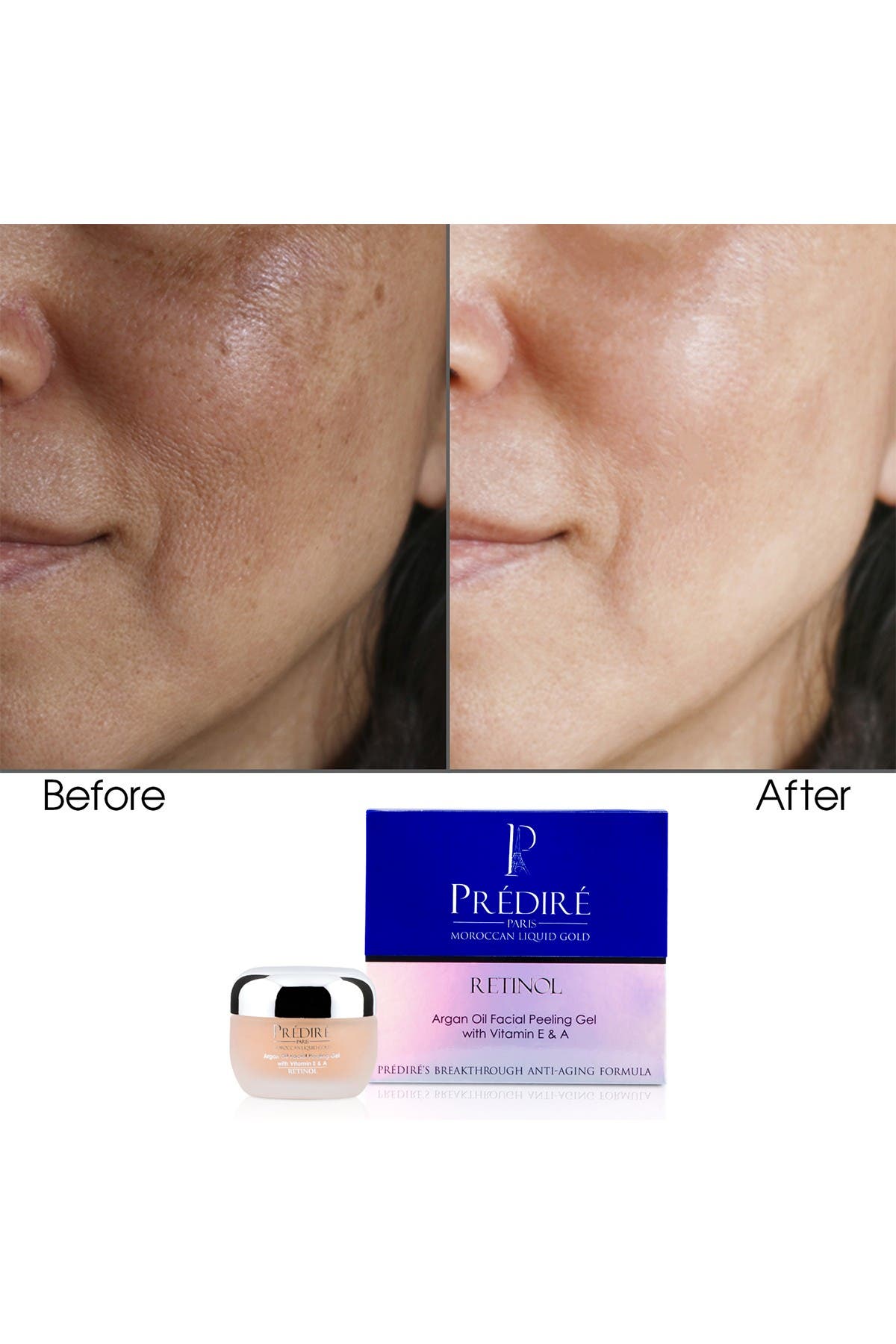 Predire Paris Skincare Intensive Rejuvenating Pore Cleansing Facial Peeling Gel Nordstrom Rack
