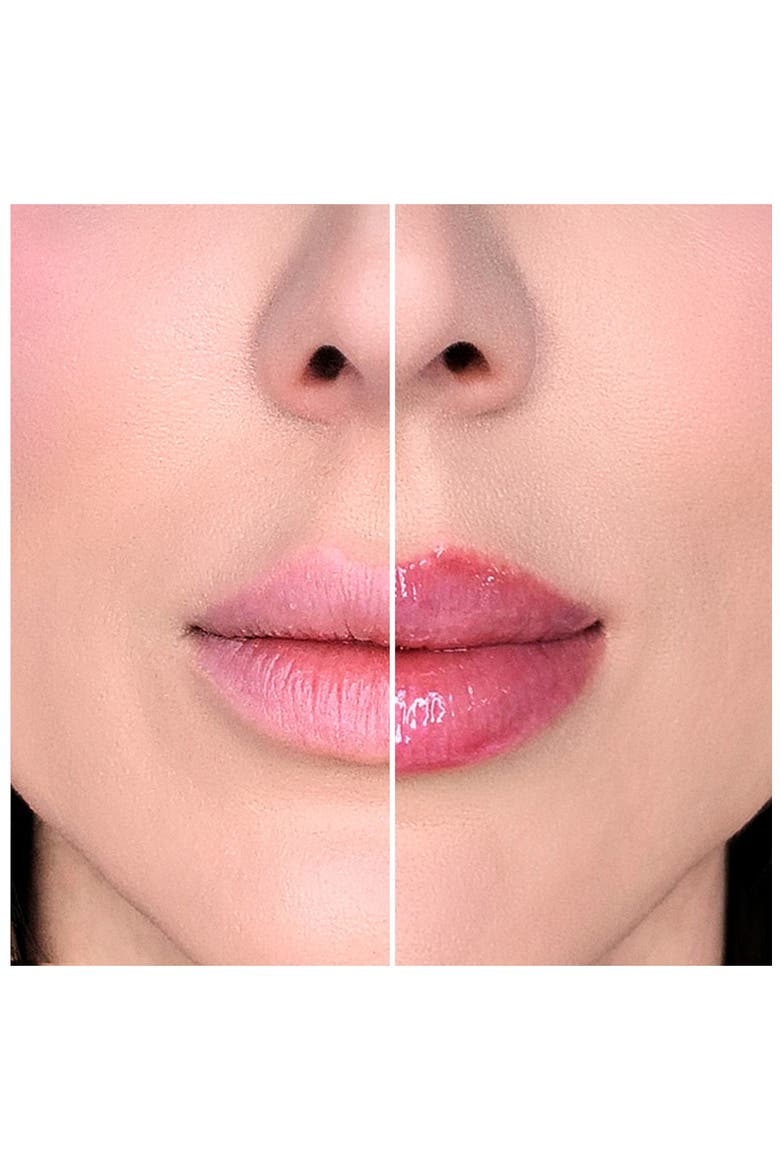 Lip Injection The Icons Set USD $33 Value, Alternate, color, NO COLOR