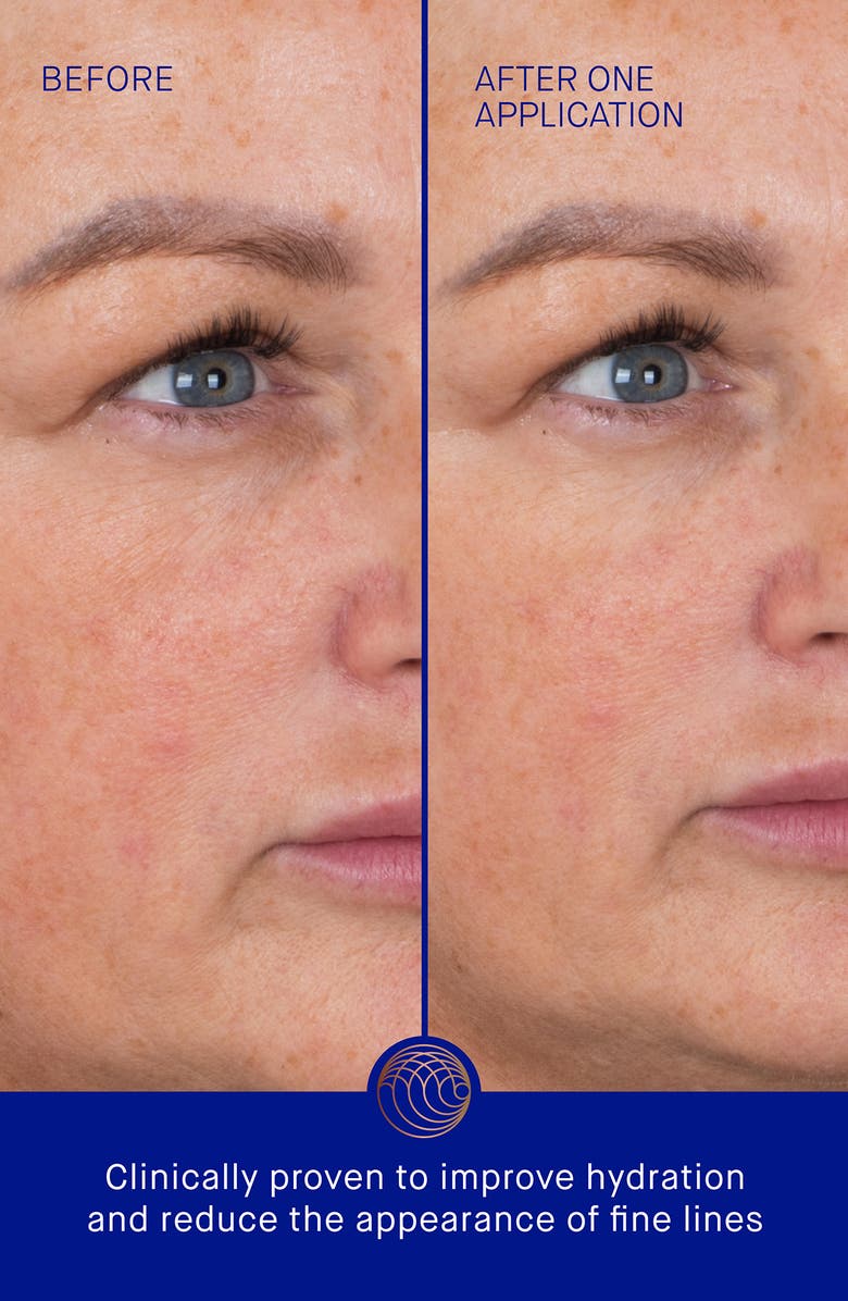 Augustinus Bader 6-Pack The Eye Patches, Alternate, color, 