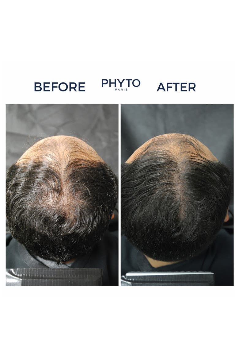Phytocyane Men Densifying Treatment for Progressive Hair Thinning, Alternate, color, NO COLOR