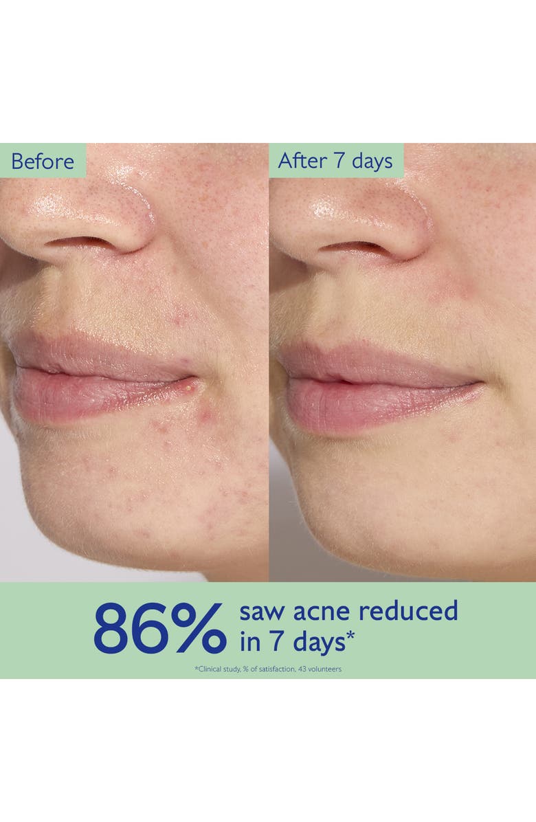 CAUDALÍE Vinopure Acne Serum, Alternate, color, 