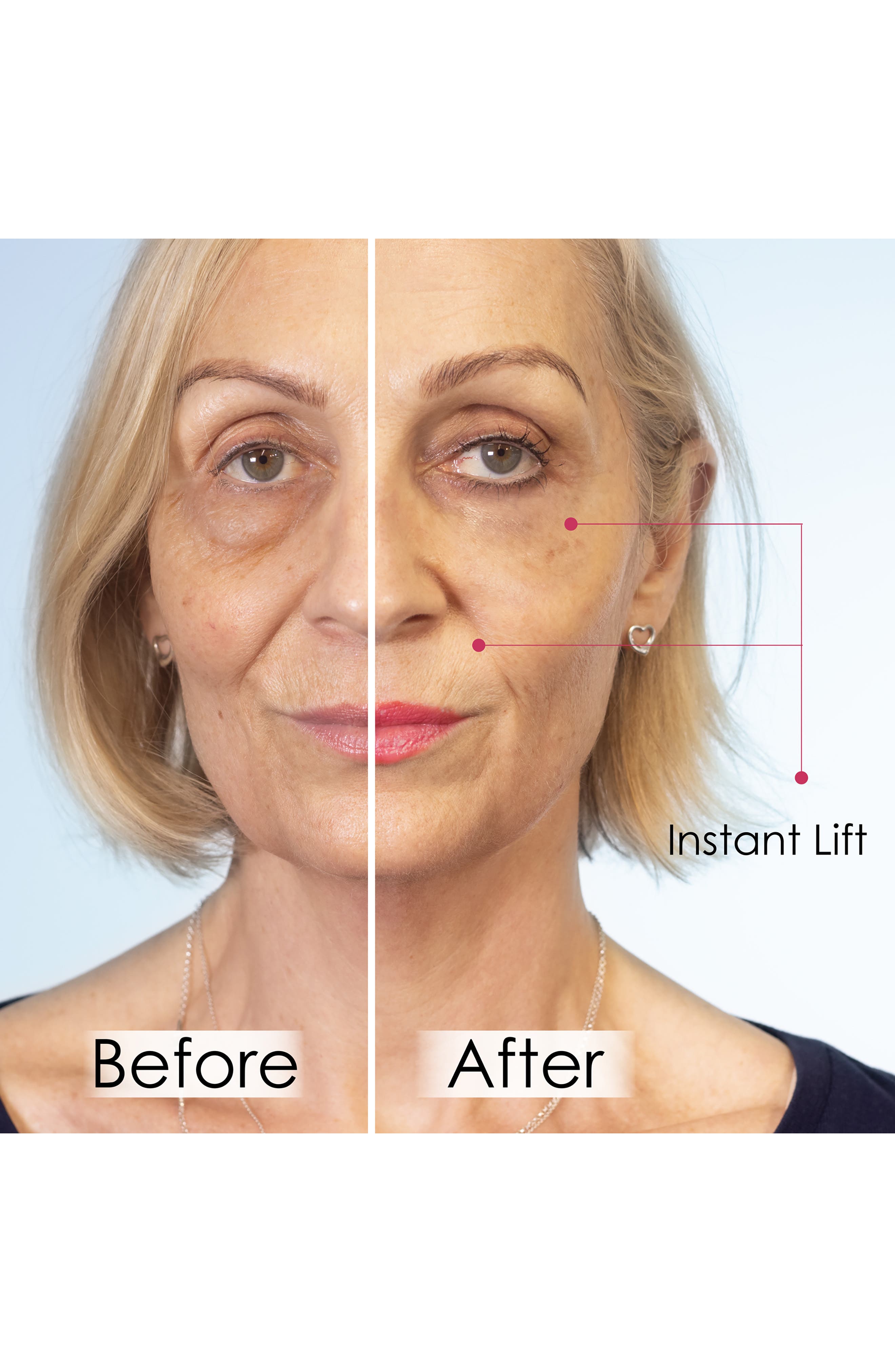 SKINCHEMISTS Set of 5 Wrinkle Killer Instant Face Lift | Nordstrom