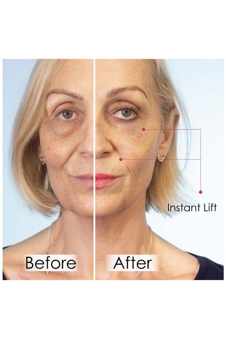 Set of 5 Wrinkle Killer Instant Face Lift, Alternate, color, NO COLOR