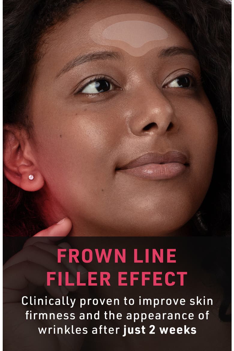 FAQ Microneedling Anti-Wrinkle Hyaluronic Acid Patches for Forehead, Alternate, color, NO COLOR