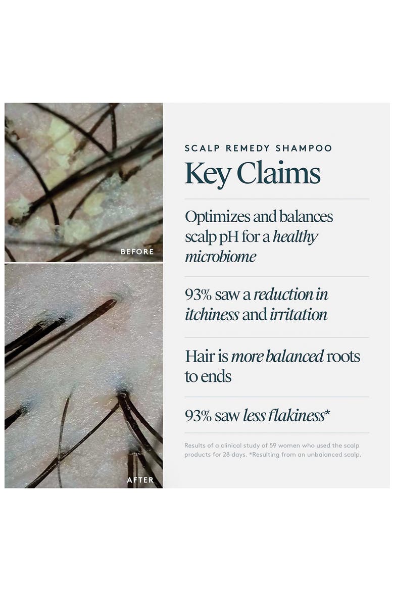 Scalp Remedy Shampoo, Alternate, color, NO COLOR