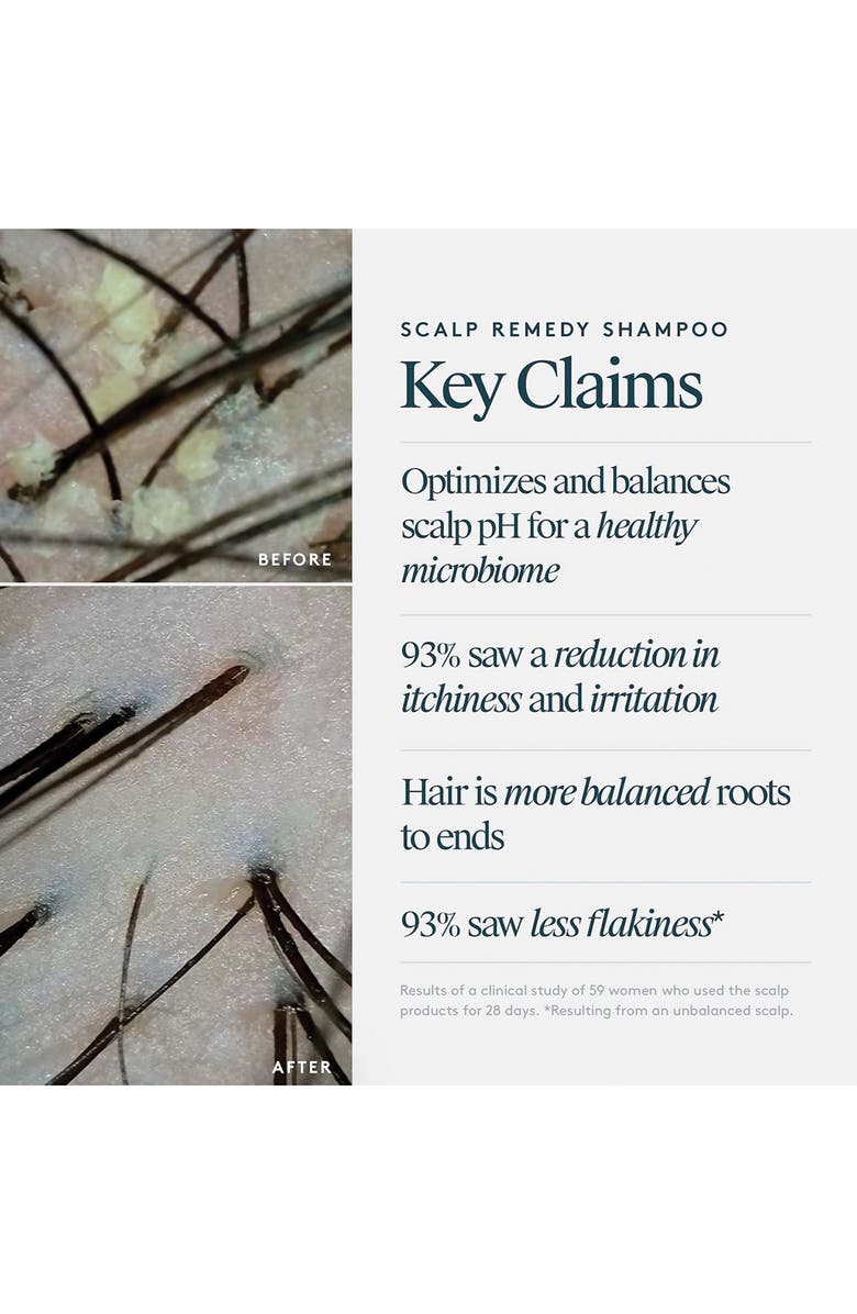 Virtue<sup>®</sup> Scalp Remedy Shampoo, Alternate, color,