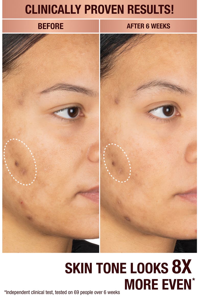 Dark Spot Correcting Radiance Recovery Serum (Nordstrom Exclusive), Alternate, color, NO COLOR