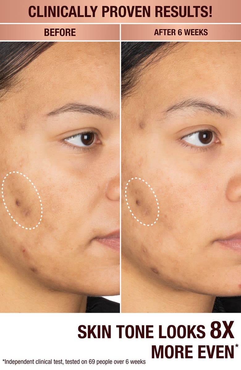 Charlotte Tilbury Dark Spot Correcting Radiance Recovery Serum, Alternate, color,