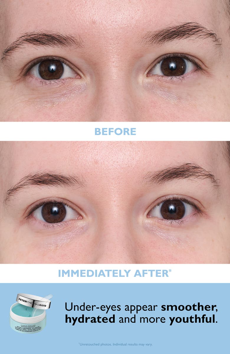Peter Thomas Roth Vitamin C & Hyaluronic Eye Patches 2-Piece Kit $120 Value, Alternate, color, 