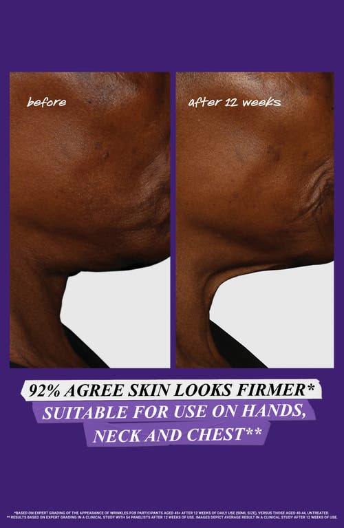 Kiehl's Since 1851 Retinol Skin-renewing Daily Micro-dose Facial Serum In Transparent