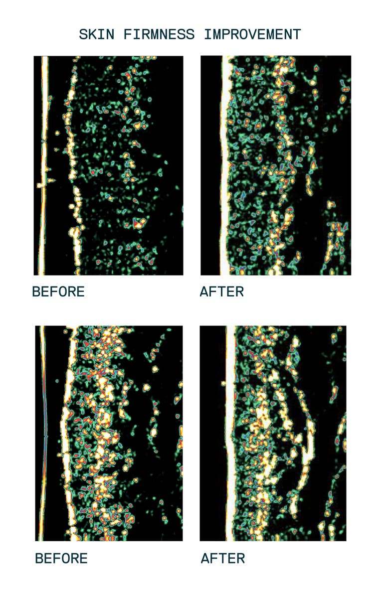 VENN SKINCARE Advanced Multi-Perfecting Red Oil Serum, Alternate, color, 