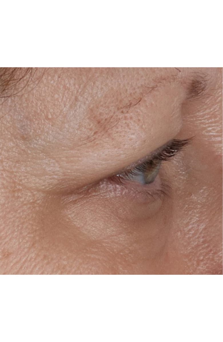 Perricone MD Vitamin C Ester CCC + Ferulic Brightening Under-Eye Cream, Alternate, color, 