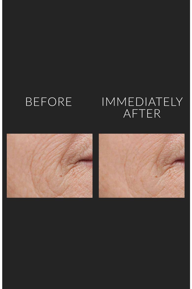 Jumbo DermalQuench Liquid Lift™ Advanced Wrinkle Treatment, Alternate, color, NO COLOR