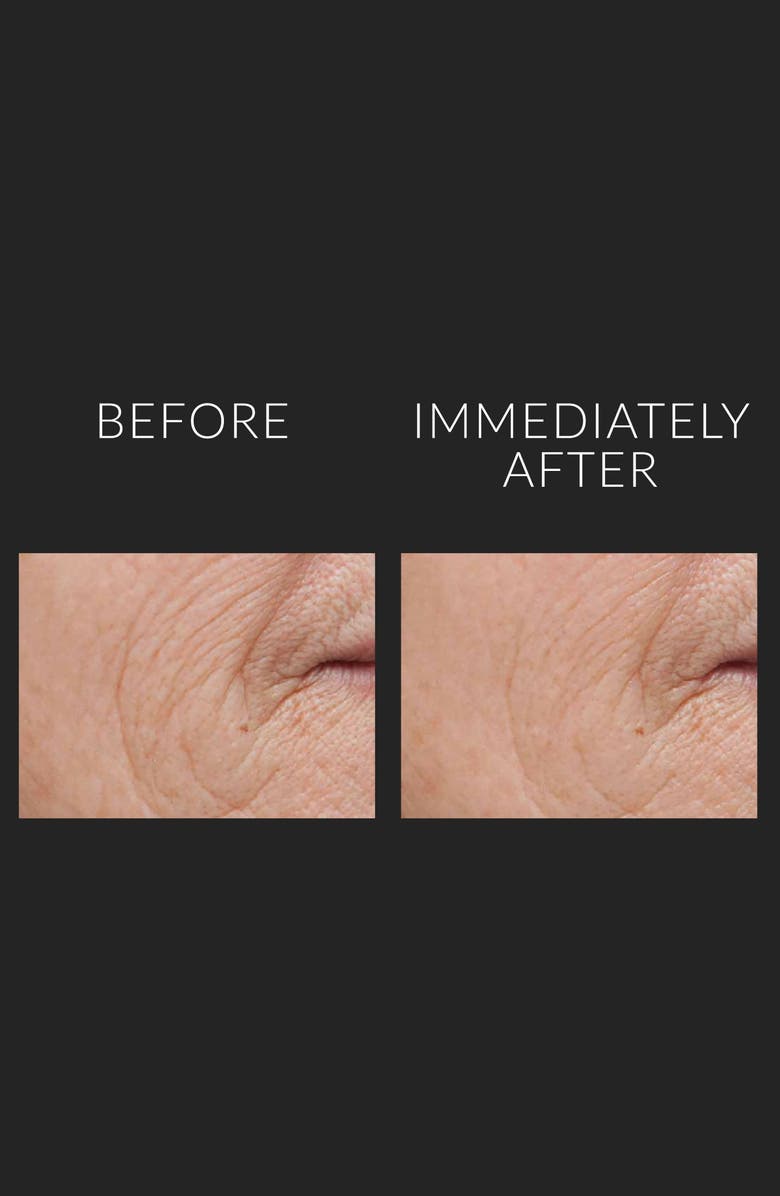 Kate Somerville<sup>®</sup> Jumbo DermalQuench Liquid Lift<sup>™</sup> Advanced Wrinkle Treatment, Alternate, color,