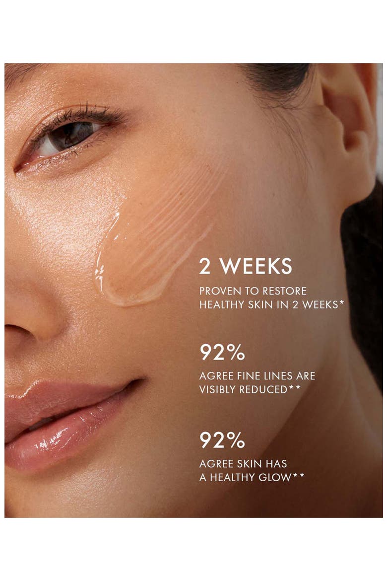 11 Days of Radiance Gift Set $815 Value, Alternate, color, NO COLOR