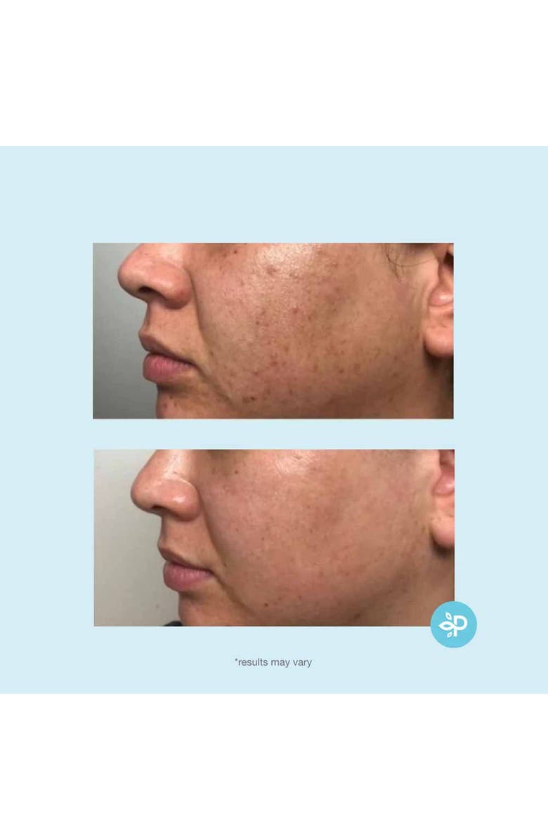 Perfect Image Revitaboost Peel Pads 35% 30ct, Alternate, color,