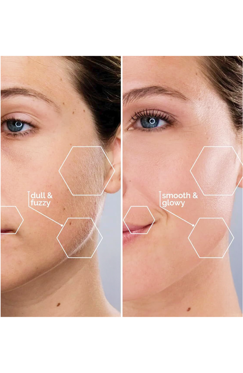 MICHAEL TODD BEAUTY Sonicsmooth Pro+ 2 in 1 Facial Exfoliation & Peach Fuzz Hair Removal System, Alternate, color, Reflects All Light Fully.