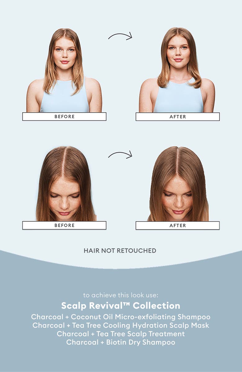 Briogeo Scalp Revival Kit $46 Value, Alternate, color, 