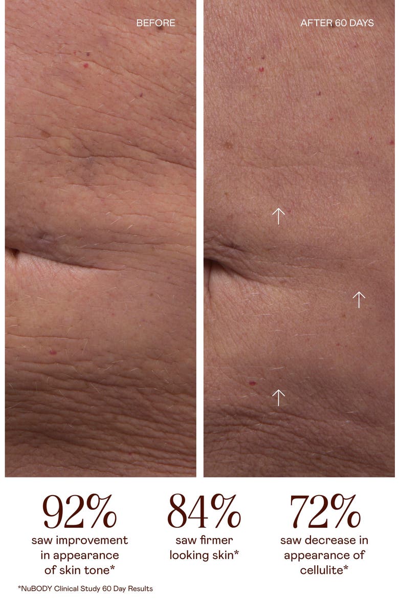 NUBODY Starter Kit - Smooth & Tone Full Body Microcurrent Device, Alternate, color, NO COLOR