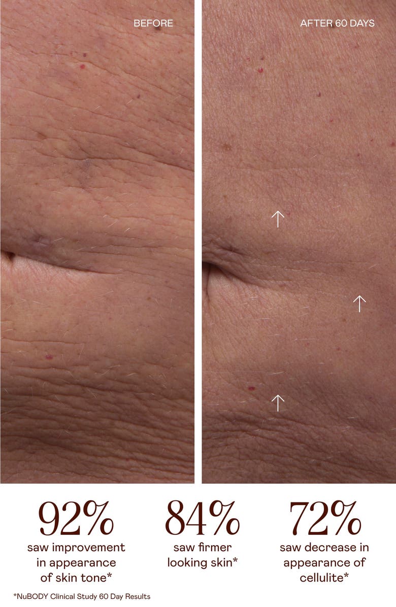 NuFACE<sup>®</sup> NuBODY Skin Toning Microcurrent Device Kit $479 Value, Alternate, color, 
