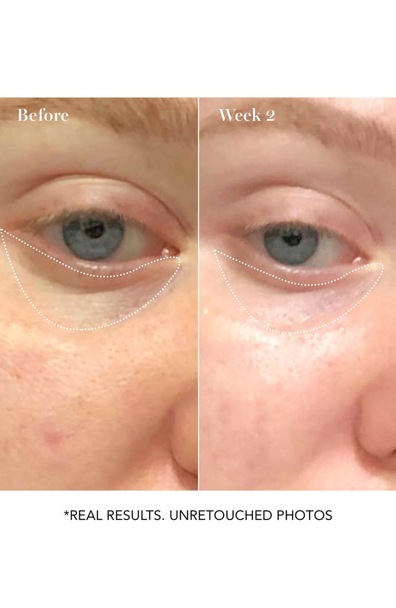 Saturday Skin Wide Awake Brightening Eye Cream, Alternate, color,