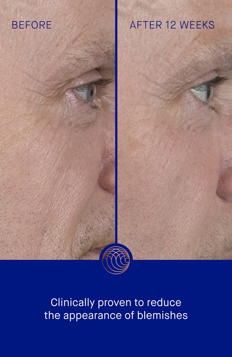 Augustinus Bader The Serum, Alternate, color, Regular