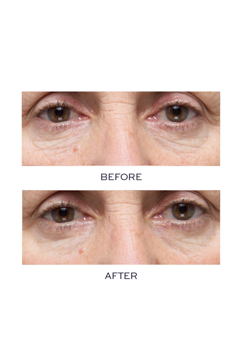 Pro-Collagen Hydra-Gel Eye Mask, Alternate, color, NO COLOR