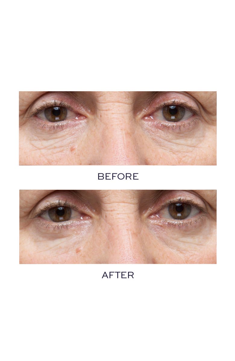 Elemis Pro-Collagen Hydra-Gel Eye Mask, Alternate, color,