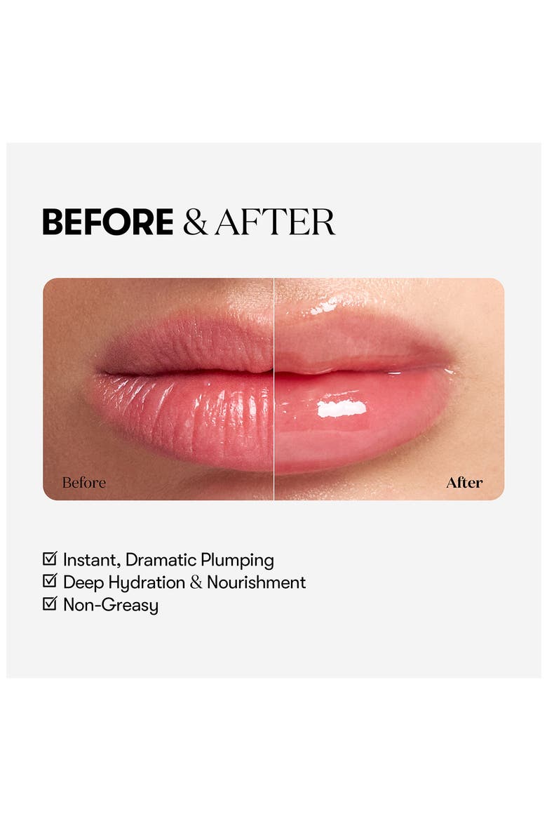 Reedle Shot Lip Plumper Expert, Alternate, color, SILVER