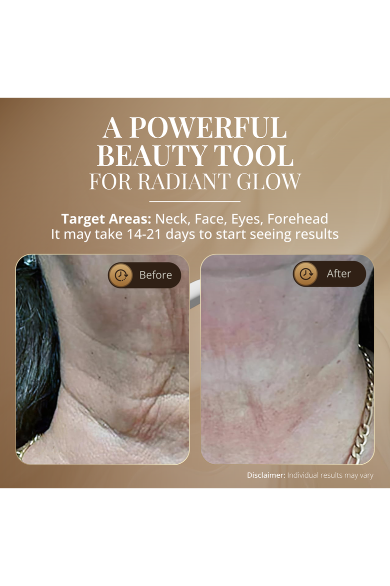 Skin Rejuvenation Beauty Device for Face and Neck, Alternate, color, NA