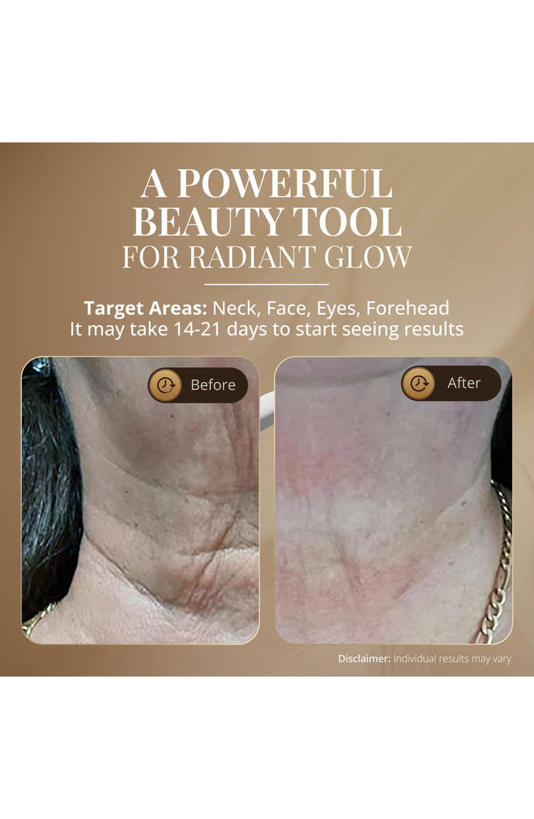 GLO24K UNLEASH THE POWER OF GOLD Skin Rejuvenation Beauty Device for Face and Neck, Alternate, color, Na