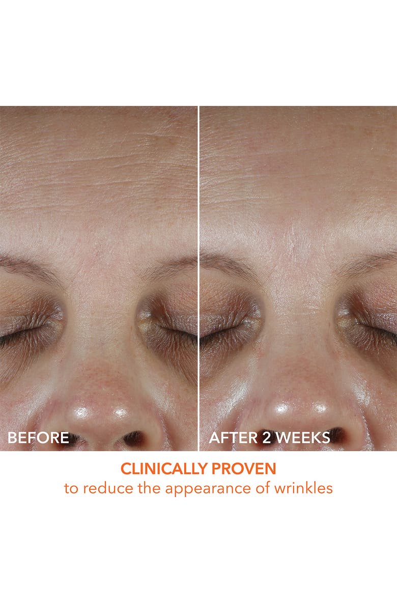 Dr. Dennis Gross Skincare Vitamin C Lactic Oil-Free Radiant Moisturizer, Alternate, color,