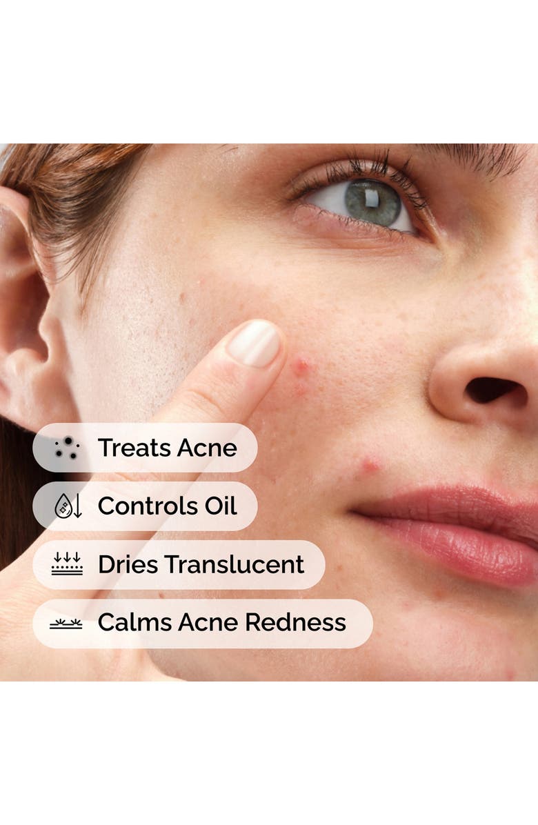 The Ordinary Sulfur 10% Powder-to-Cream Concentrate, Alternate, color, 